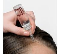Sérum Anti-Chute Capillaire, Breveté, 98% Naturel, 20mL, Pour Hommes et Femmes, Alternative Naturelle au Minoxidil pour Alopécie, Calvitie, Alopécie Androgénétique, pousse cheveux