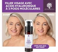Sérum Combleur Anti-Rides - 98% Naturel - Acide Hyaluronique Pur Et Moringa Visage - 30 Ml - Fabriqué En Italie