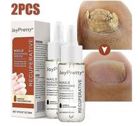 Serum De Soin Pour Les Ongles Fongiques, Lotion Reparatrice Pour Ongles Epais Et Souples, Traitement Blanchissant Pour Les Orteils, Soins Tw