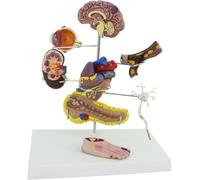 Set de 8 pièces Modèle de diabète,Modèle de diabète en médecine humain | Réplique pour l'éducation en anatomie et physiologie humaines, modèle médical de communication médecin-patient
