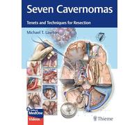 Seven Cavernomas: Tenets and Techniques for Resection