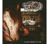 Severed Limbs - in Each Scenario You Die [Import]