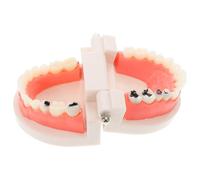 SEWOART Modèle Dentaire Amovible pour Enseignement Modèle de Dents en Plastique Solide Structure Réaliste Rose Démonstration Standard Chez le Dentiste Outil Pédagogique pour Étudiants