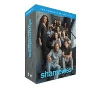 Shameless: L'intégrale Saisons 1 À 11 - Coffret Dvd 34 Disques
