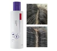 Shampoing pour cheveux gras pour femme, 205 ml, après-shampoing fortifiant et doux pour le soin de la tête | Shampooing équilibrant pour cuir chevelu gras | Pour soins de la tête, voyage, maison