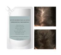 Shampooing Volumateur Pour Cheveux Fins - Shampooing Renforcateur Volumisant,Solution Nettoyante 300ml à Base de Naturelles,Pour Hommes et Femmes Adultes