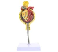 SHERCHPRY Modèle Anatomique Médical du Glomérule Humain avec Socle Modèle Pédagogique de Glomérule Outil D’Enseignement en Anatomie Physiologie Humaine 1 Pièce