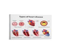 SHFTQXSLAT Heart Disease Chart Symptoms and Prevention Educational Poster for Doctor Office Clinic Hospital Health Education Class Wall-Art(Unframed,12x18inch(30x45cm))