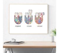 SHINERING Peinture Sur Toile Avec Implant Dentaire, Couronne Dentaire, Affiches, Dentiste, Anatomie Dentaire, Art Mural Médical, Images Pour Décoration De Clinique Dentaire 60X80Cm Sans Cadre