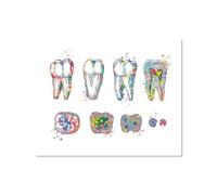 SHINERING Peinture Sur Toile Avec Implant Dentaire, Couronne Dentaire, Affiches, Dentiste, Anatomie Dentaire, Art Mural Médical, Images Pour Décoration De Clinique Dentaire 30X40Cm Sans Cadre