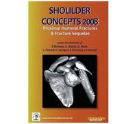 Shoulder Concepts 2008 - Proximal Humeral Fractures & Fracture Sequelae