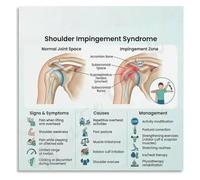 Shoulder Impingement Rotator Cuff Poster Canvas Wall Art Anatomy Chart for Physical Therapy Clinic Decor(Unframed,08x12inch(20x30cm))