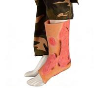 Simulateur de pansement pour brûlures, modèle portable en silicone de plaie brûlée pour la formation aux soins des plaies destiné aux infirmières en formation médicale(Gloves)