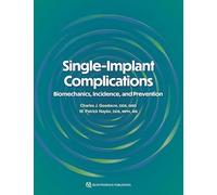 Single-Implant Complications: Biomechanics, Incidence, and Prevention