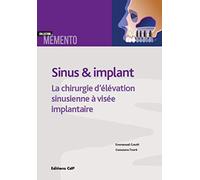 Sinus et implants: La chirurgie d'élévation sinusienne à visée implantaire