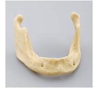 sjdoPulse Modèle D'Enseignement D'Étude des Dents Dentaires - Modèle De Pratique D'Implant De Mandibule sans Gencive - Modèle De Dent De Formation Dentaire Modèle D'Implant De Mand(A)