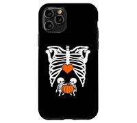 Skeleton Twin Baby Pumpkin Pregnancy Alert Mom Halloween Coque pour iPhone 11 Pro