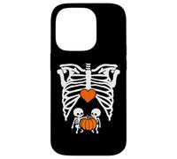Skeleton Twin Baby Pumpkin Pregnancy Alert Mom Halloween Coque pour iPhone 14 Pro