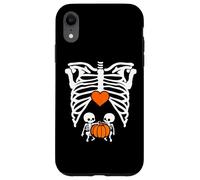 Skeleton Twin Baby Pumpkin Pregnancy Alert Mom Halloween Coque pour iPhone XR