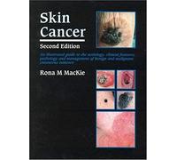 Skin Cancer: An Illustrated Guide To The Aetiology, Clinical Features, Pathology And Management Of Benign And Malignant Cutaneous T