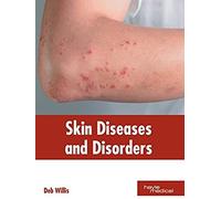 Skin Diseases And Disorders