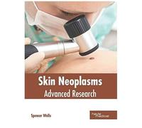 Skin Neoplasms: Advanced Research