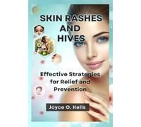 Skin Rashes And Hives: Effective Strategies For Relief And Prevention