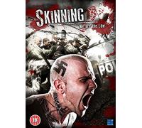 Skinning-We are The Law [Edizione: Regno Unito] [Import]