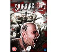 Skinning-We are The Law [Edizione: Regno Unito] [Import]