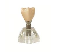 SLRMKK Modèle d'implant Dentaire - Modèle d'enseignement Dentaire Modèle de Dents détachables - Modèle de Dents dentaires en résine, Dentiste pour communiquer avec Les Patients Modèle Oral - pour l'a