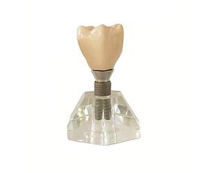 SLRMKK Modèle d'implant Dentaire - Modèle d'enseignement Dentaire Modèle de Dents détachables - Modèle de Dents dentaires en résine, Dentiste pour communiquer avec Les Patients Modèle Oral - pour l'a