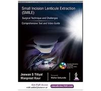 Small Incision Lenticule Extraction (Smile)