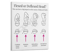 SMGLRUEAT Birth Process Educational Poster Cardinal Movements and Fetal Position Chart for Nursing School Skills(Unframed,12x18inch(30x45cm))