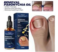 Soin des ongles incarnés, élimination des ongles, Paronyfriend173, Traitement des ongles incarnés, Meilleure