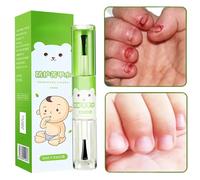 Solution Anti-Ongles Rongés,Arrêt Sûr de la Succion du Pouce pour - 10ml Effet Protecteur pour la Prévention de la Succion du Pouce en Maternelle à la Maison en Intérieur en