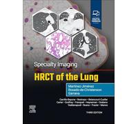 Specialty Imaging: Hrct of the Lung