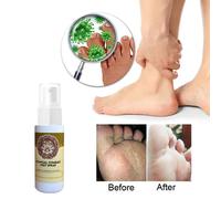 Spray De Soin Des Pieds, Dissolvant D'odeur De Sueur, Déodorant, Outil Antifongique Pour Béribéri, Érosion Des Démangeaisons, Ampoules Épluchantes, Anti Bcbt