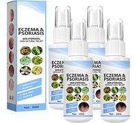 Spray de traitement du psoriasis à base de plantes pour eczéma - Brume apaisante pour soulager le psoriasis - Soulage les démangeaisons de la peau - Aide à apaiser la peau