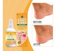 Spray Pour Les Pieds, Hydratant Pour Les Jambes Sèches, 30 Ml, Spray Hydratant Pour Jambes, Liquide Réparateur De Plaies Des Pieds, Traitement Apaisant Pour La Peau Pour Adultes, Adolescents, Jeun