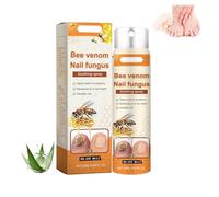 Spray réparateur avancé pour les ongles, sérum essence réparateur pour les ongles, nourrissant et hydratant pour les cuticules, pénètre en profondeur dans la peau, en douceur, solution (1PCS)