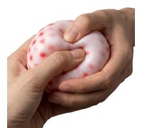 Squeeze Toys - Pimple Pop Soft Pear, Non-Sticky Sensory Fidget with Realistic Pus Refill Simulation, Stress Ease Poppings Toy, Tactile Skin Picking Substitute, Unique Novelty Gadget for Youth