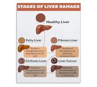 SSOPTMCB Biology Classroom Poster Liver Organ Educational Chart Metal Tin Sign Wall-Art for School Home Office Decor(Framed,12x18inch(30x45cm))