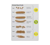SSOPTMCB Poop Chart Stool Health Guide Digestive System Poster Educational Wall-Art for Bathroom Home Decor(Framed,16x24inch(40x60cm))