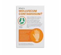 SSOPTMCB Skin Anatomy Poster Human Skin Structure Diagram Dermatology Educational Chart for Classroom Clinic Wall-Art(Framed,12X18inch(30X45cm))