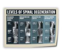 SSOPTMCB Spine Anatomy Art Print - Detailed Diagram of Vertebral Column, Educational Science Wall Decor for Chiropractor Office, Study, Clinic(Framed,08x12inch(20x30cm))
