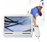 SSQUZA Analyseur de Cheveux de Diagnostic de Peau, Microscope Numérique pour Cuir Chevelu et Follicule, Détecteur de Cuir Chevelu Cutané de 10 Pouces, Testeur de Follicules Pileux HD