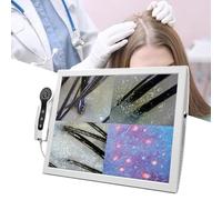 SSQUZA Analyseur De Cheveux Diagnostic Peau 15 Pouces,70x/200x Microscope Professionnel Scanner De Peau Faciale pour des Problèmes De Peau,Essai De Follicule Et Analyse De Peau pour L'usage