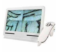 SSQUZA Machine D'analyse Cheveux Diagnostic Peau, Détecteur Cuir Chevelu Cutané 10 Pouces, Testeur HD Follicule Pileux, Système Scanner Diagnostic Peau, Analyseur Cheveux, Scanner D'analyse