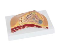 Supkancl 1: 1 Modèle de Section médiane la pathologie féminine Humaine d'anatomie kit Type Table lésions mammaires