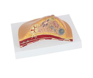Supkancl 1: 1 Modèle de Section médiane la pathologie féminine Humaine d'anatomie kit Type Table lésions mammaires